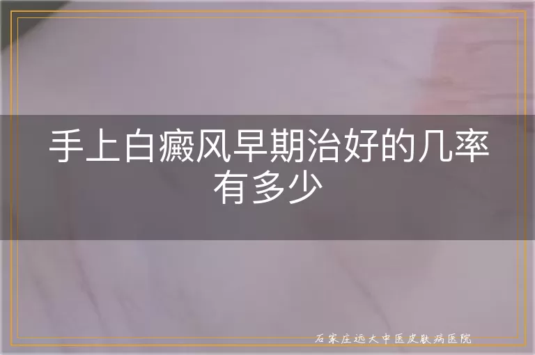 手上白癜风早期治好的几率有多少