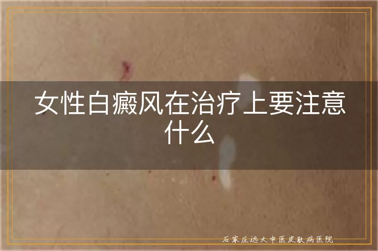 女性白癜风在治疗上要注意什么