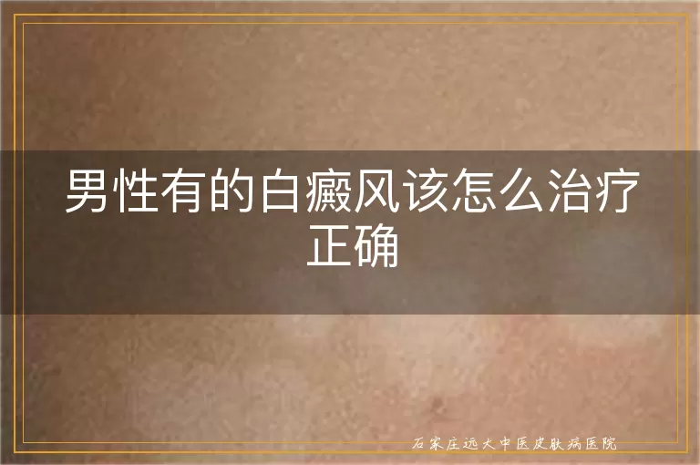 男性有的白癜风该怎么治疗正确