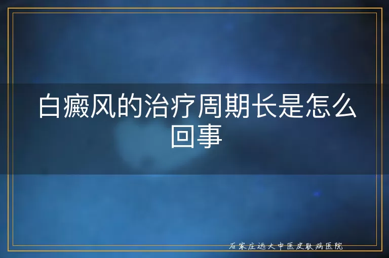 白癜风的治疗周期长是怎么回事