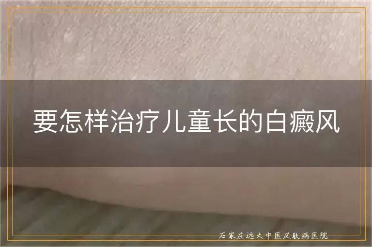 要怎样治疗儿童长的白癜风