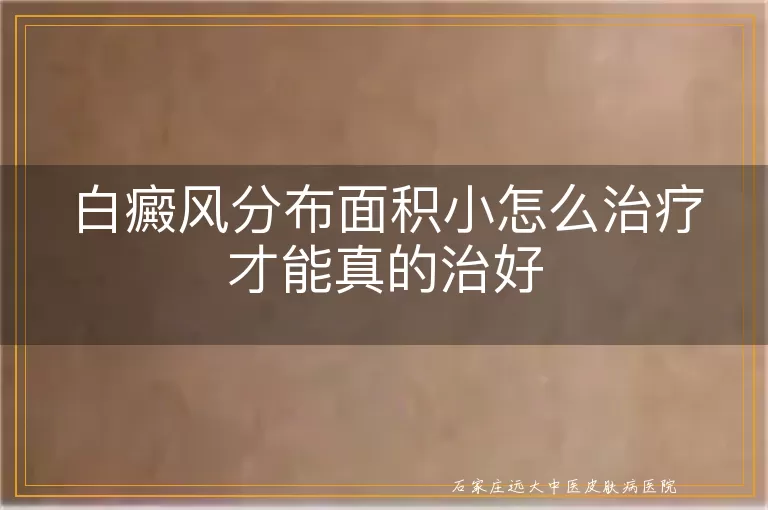 白癜风分布面积小怎么治疗才能真的治好
