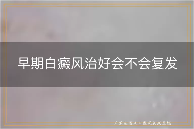 早期白癜风治好会不会复发