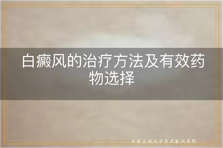 白癜风的治疗方法及有效药物选择