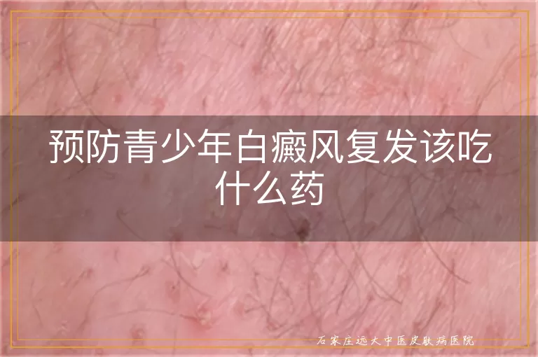 预防青少年白癜风复发该吃什么药