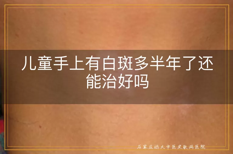 儿童手上有白斑多半年了还能治好吗