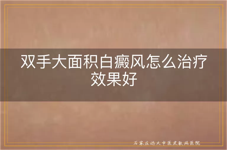 双手大面积白癜风怎么治疗效果好