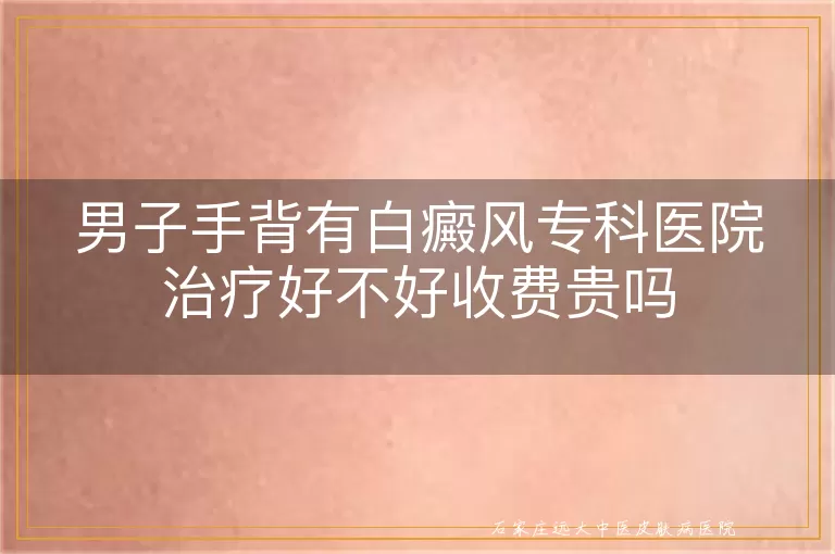 男子手背有白癜风专科医院治疗好不好收费贵吗