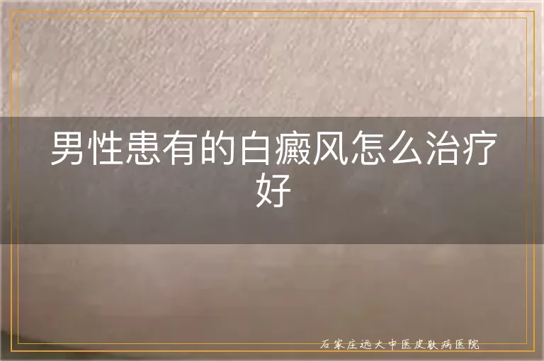 男性患有的白癜风怎么治疗好