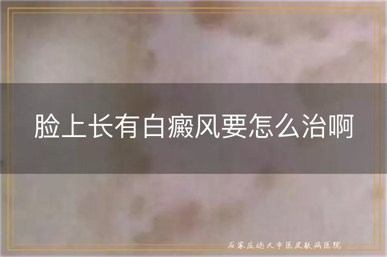 脸上长有白癜风要怎么治啊