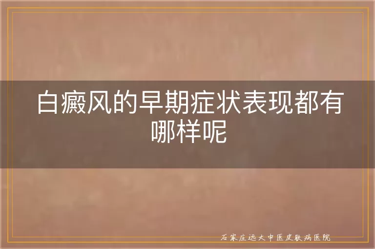 白癜风的早期症状表现都有哪样呢