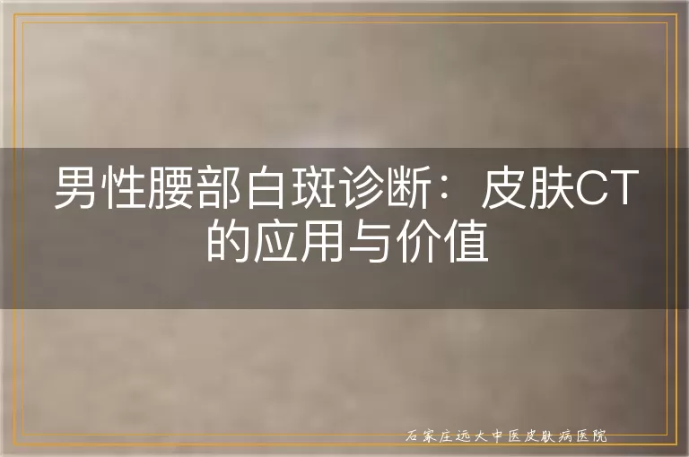 男性腰部白斑诊断：皮肤CT的应用与价值