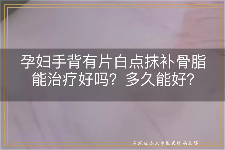 孕妇手背有片白点抹补骨脂能治疗好吗？多久能好？