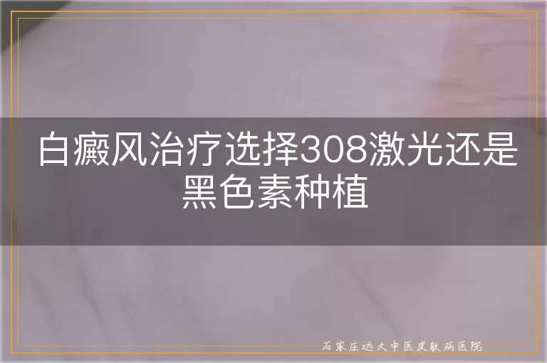 白癜风治疗选择308激光还是黑色素种植