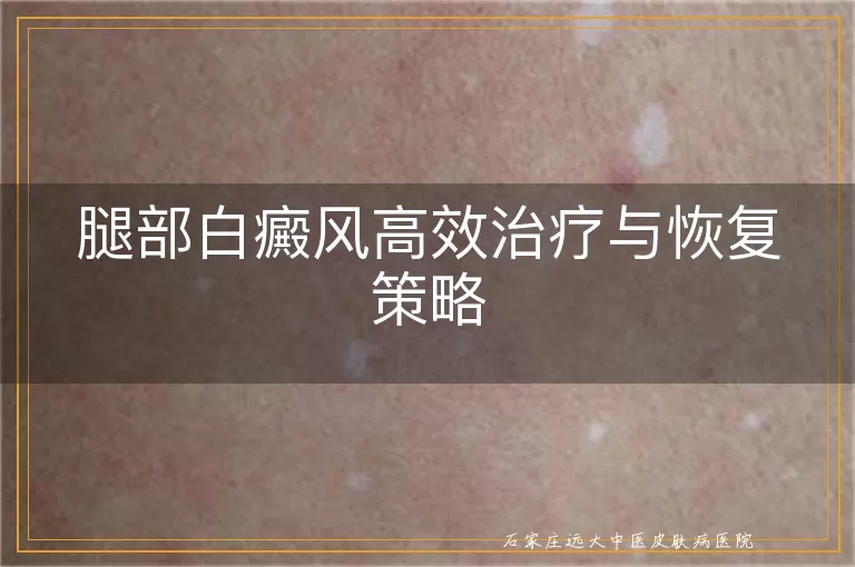 腿部白癜风高效治疗与恢复策略