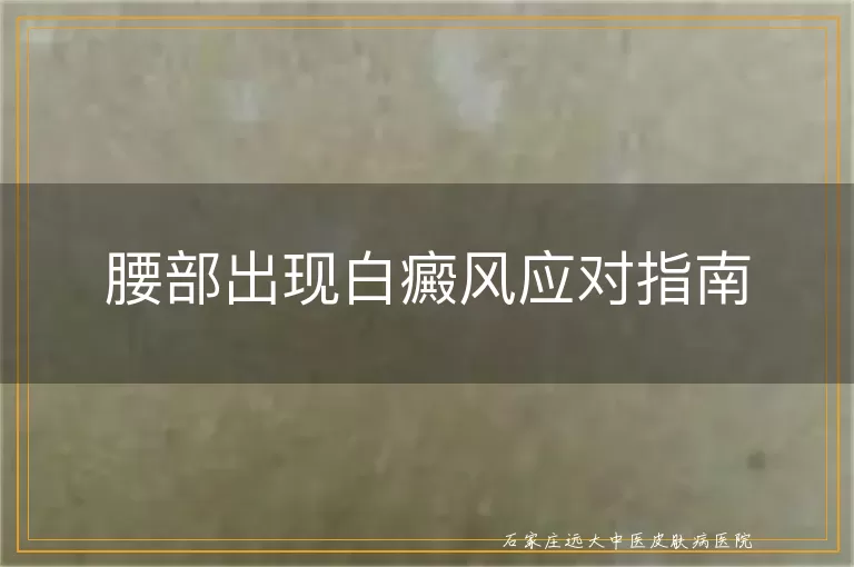 腰部出现白癜风应对指南