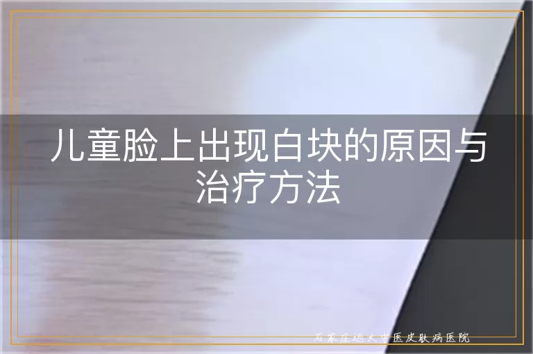 儿童脸上出现白块的原因与治疗方法
