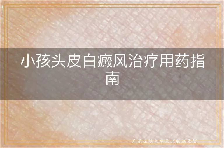 小孩头皮白癜风治疗用药指南