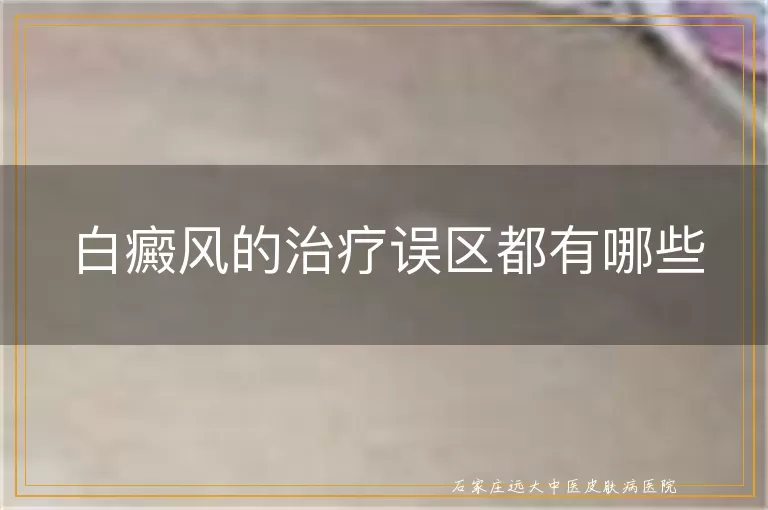 白癜风的治疗误区都有哪些