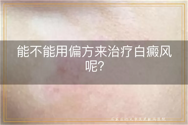 能不能用偏方来治疗白癜风呢？