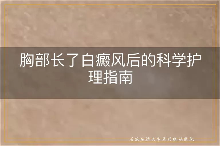 胸部长了白癜风后的科学护理指南