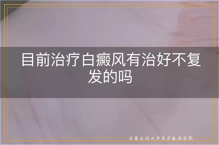 目前治疗白癜风有治好不复发的吗