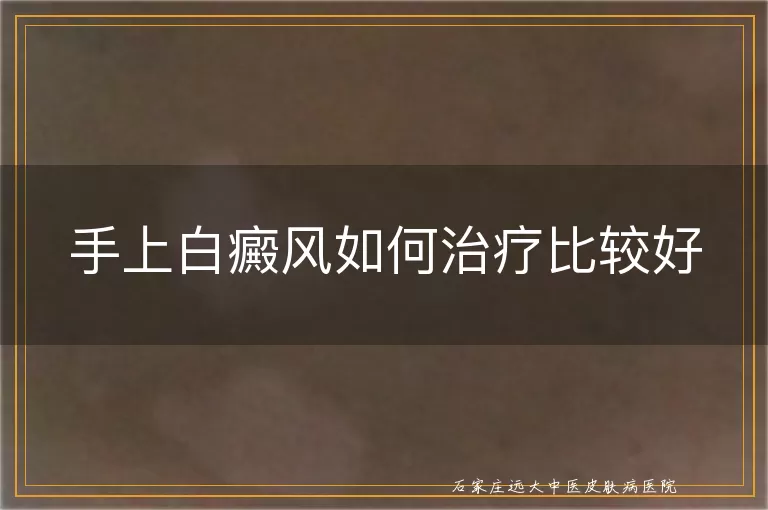手上白癜风如何治疗比较好