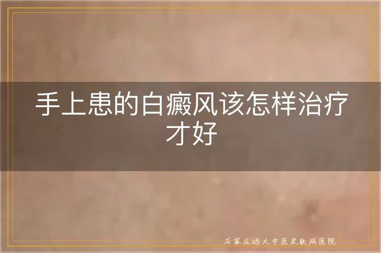 手上患的白癜风该怎样治疗才好