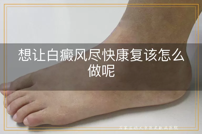 想让白癜风尽快康复该怎么做呢