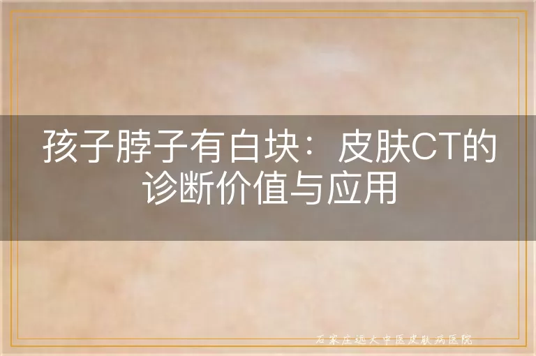 孩子脖子有白块：皮肤CT的诊断价值与应用