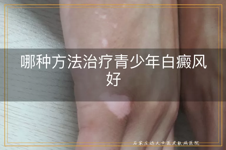 哪种方法治疗青少年白癜风好