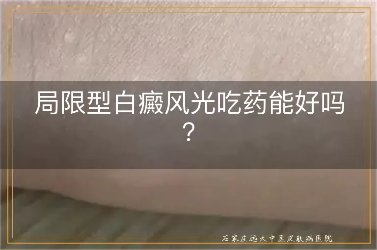 局限型白癜风光吃药能好吗？