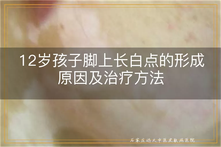 12岁孩子脚上长白点的形成原因及治疗方法