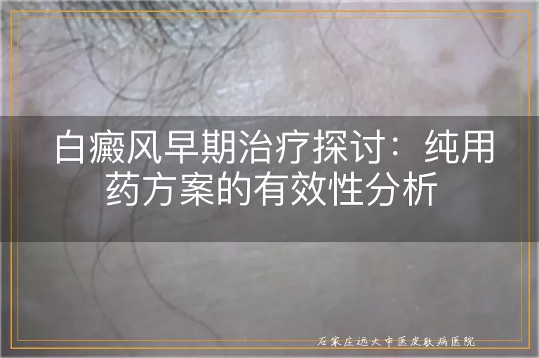 白癜风早期治疗探讨：纯用药方案的有效性分析