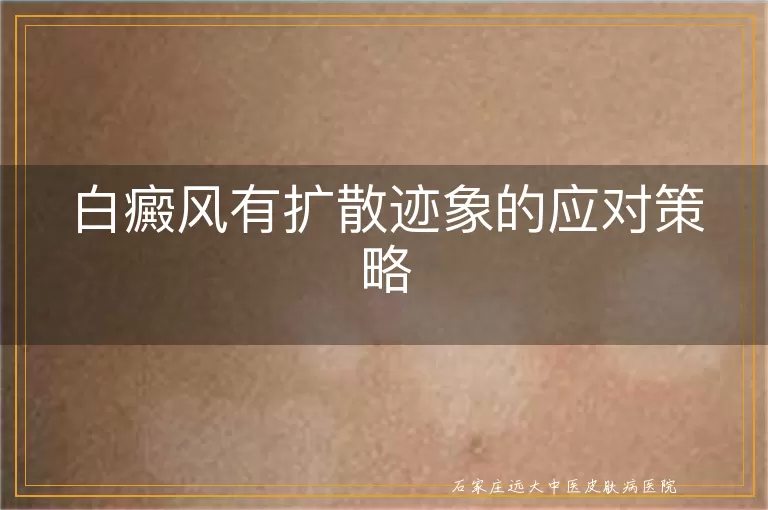 白癜风有扩散迹象的应对策略