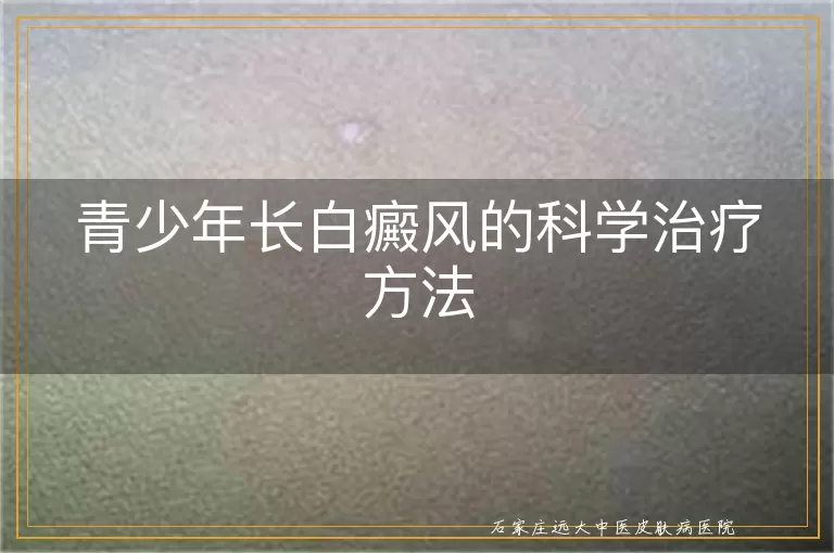 青少年长白癜风的科学治疗方法