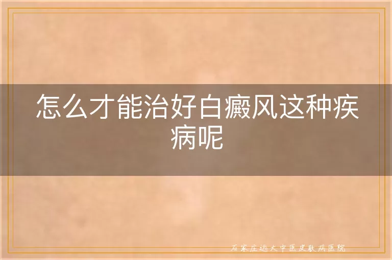 怎么才能治好白癜风这种疾病呢