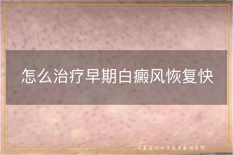 怎么治疗早期白癜风恢复快