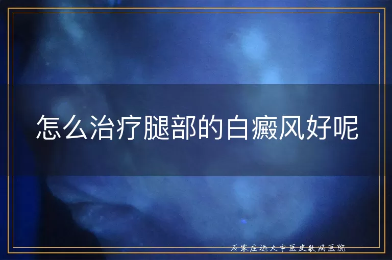 怎么治疗腿部的白癜风好呢
