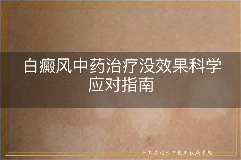 白癜风中药治疗没效果科学应对指南