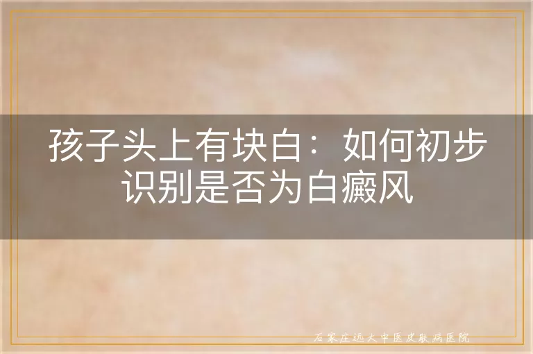 孩子头上有块白：如何初步识别是否为白癜风