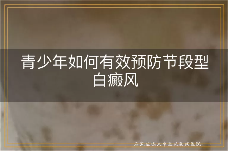 青少年如何有效预防节段型白癜风