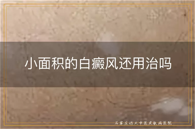 小面积的白癜风还用治吗