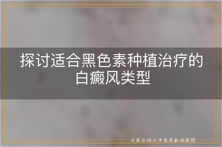 探讨适合黑色素种植治疗的白癜风类型