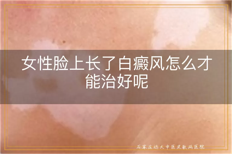 女性脸上长了白癜风怎么才能治好呢