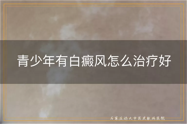 青少年有白癜风怎么治疗好