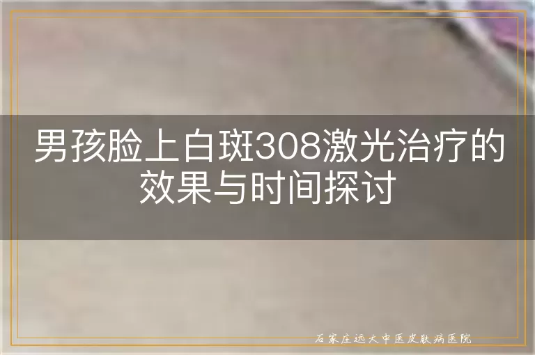 男孩脸上白斑308激光治疗的效果与时间探讨