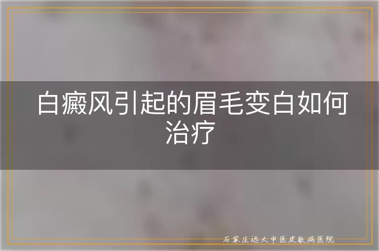 白癜风引起的眉毛变白如何治疗