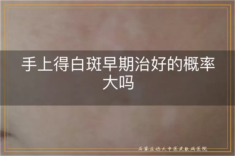 手上得白斑早期治好的概率大吗