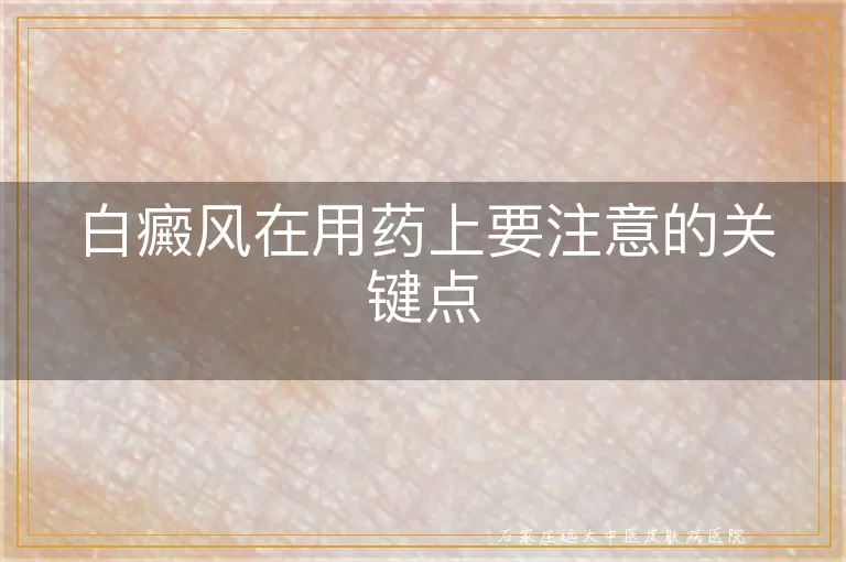 白癜风在用药上要注意的关键点